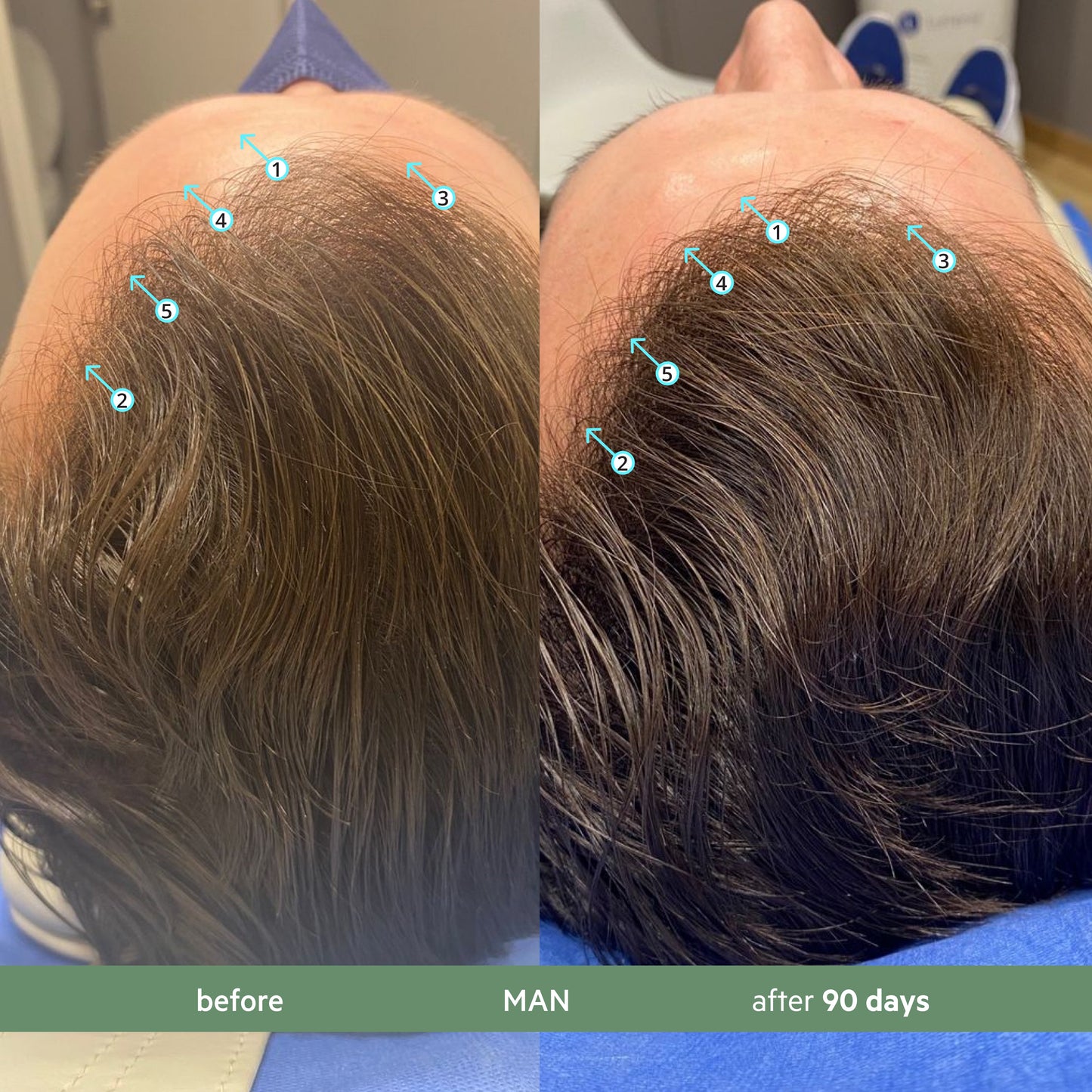 Revita.CBD | Champú CBD superantioxidante para la DENSIDAD capilar