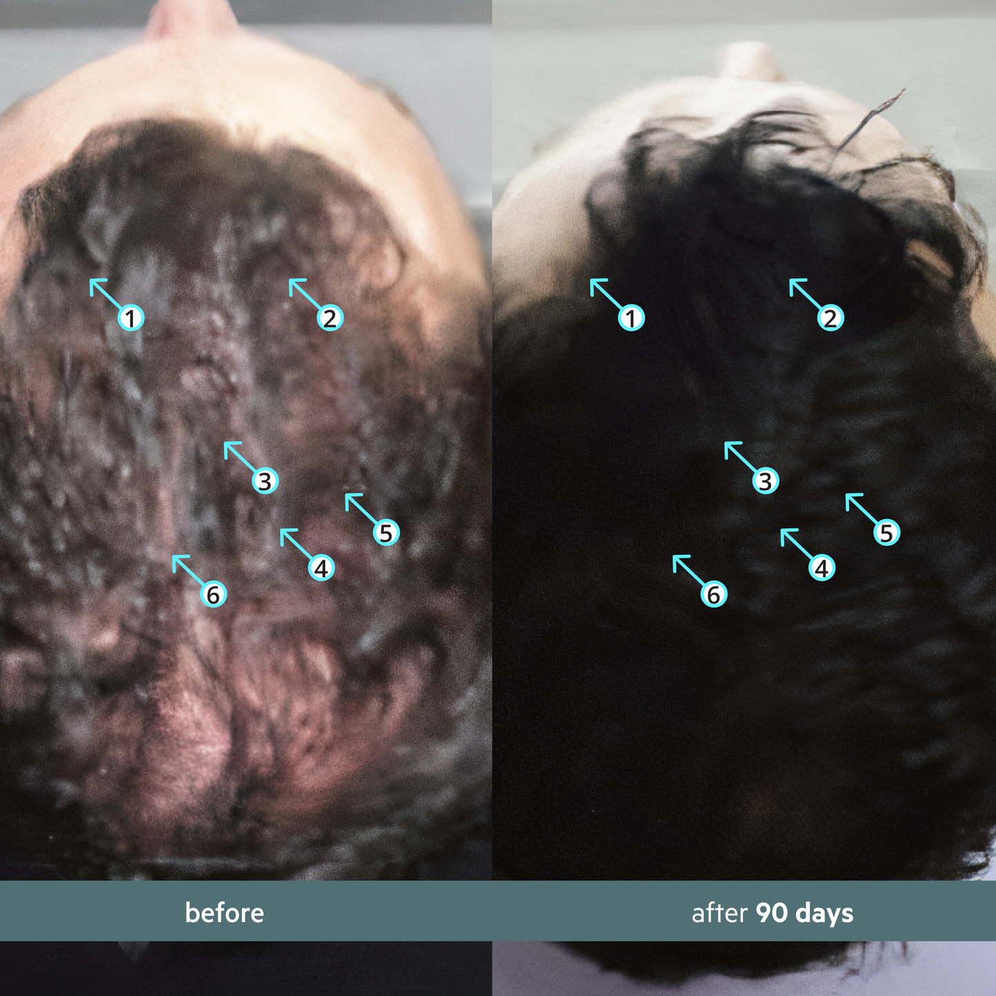 Spectral Booster | Sérum adaptógeno antiestrés