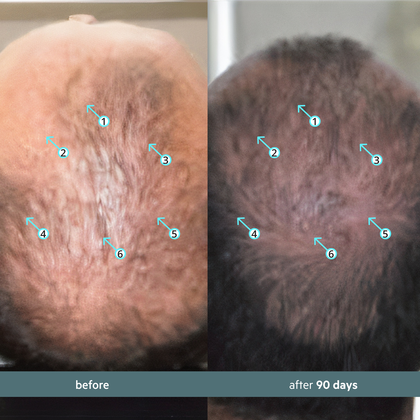 Spectral Booster | Sérum adaptógeno antiestrés