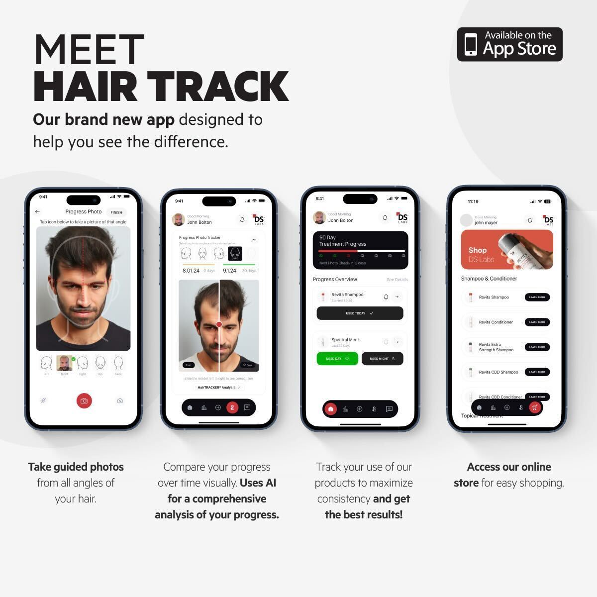 StimuROLLER+ HAIR | Sistema de estimulación capilar con microagujas 1,0 mm