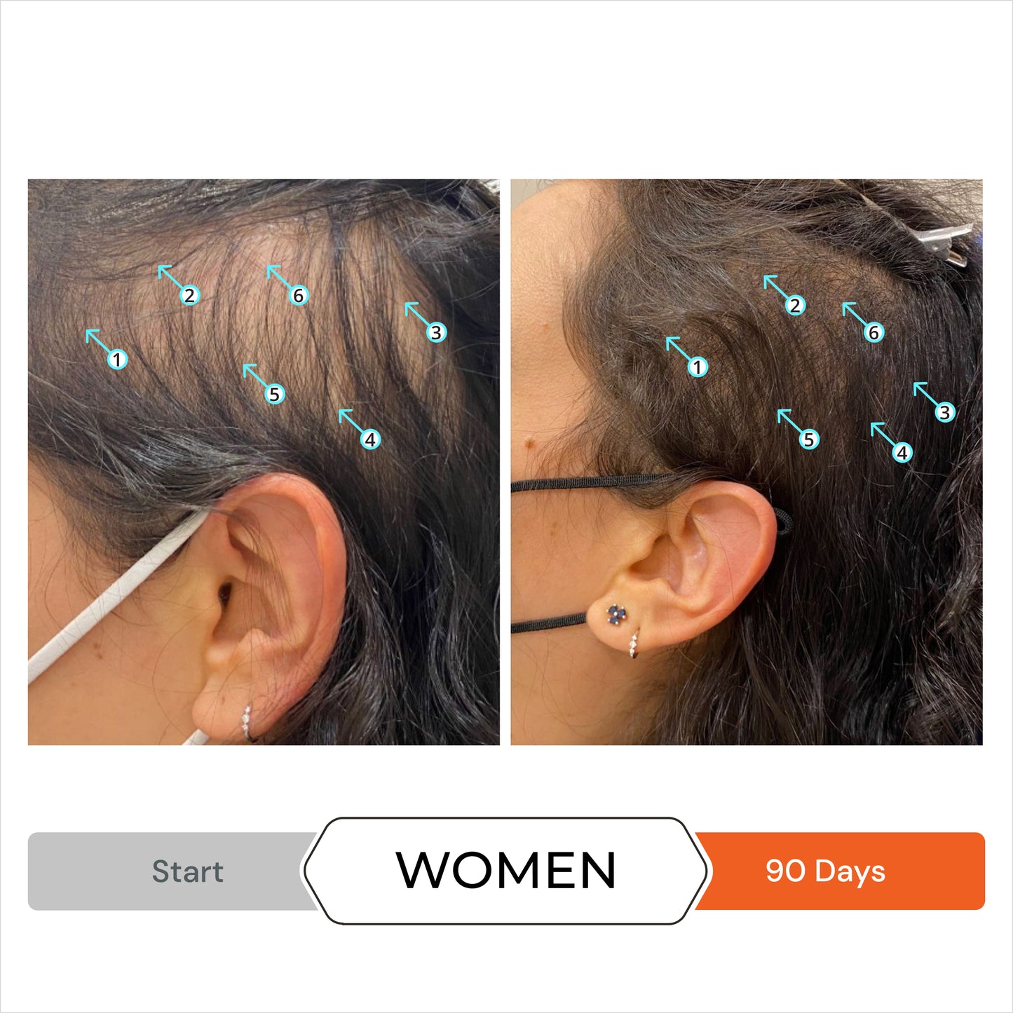 Revita® Kit | Shampoo y acondicionador