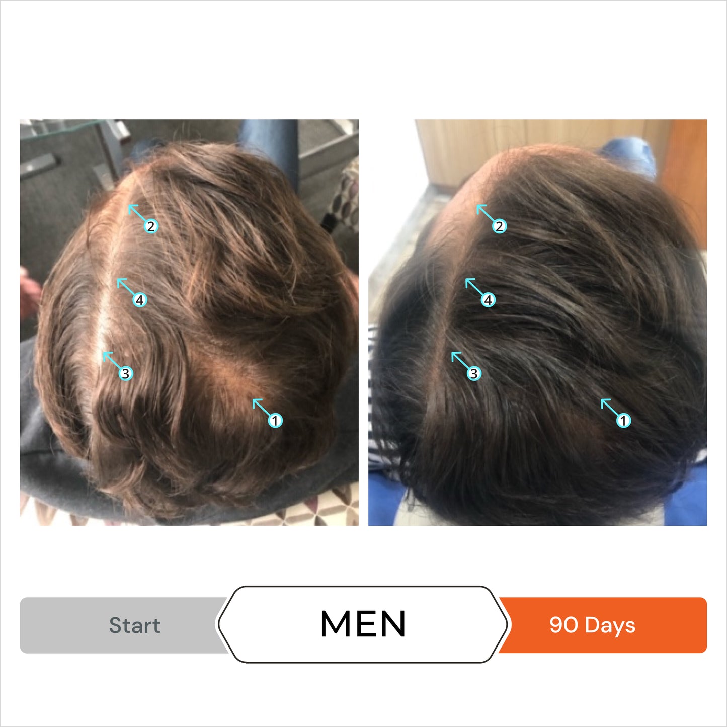 Revita® Kit | Shampoo y acondicionador