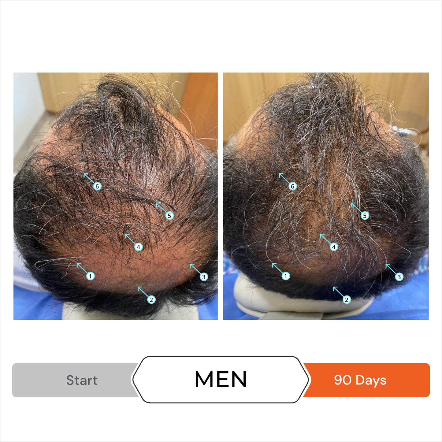 Revita® Kit | Shampoo y acondicionador