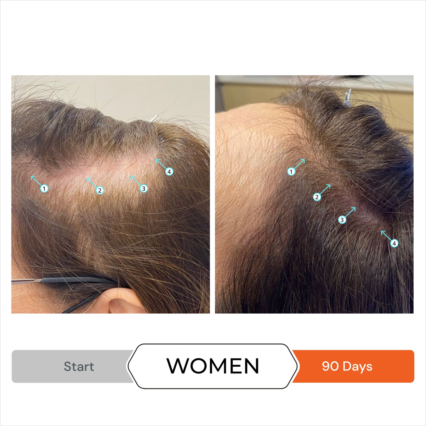 Revita® Kit | Shampoo y acondicionador