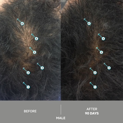 SPECTRAL EXTRA STRENGTH® | Nanoxidil 7%