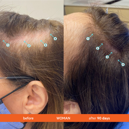 Revita | Acondicionador de alto rendimiento para la DENSIDAD capilar