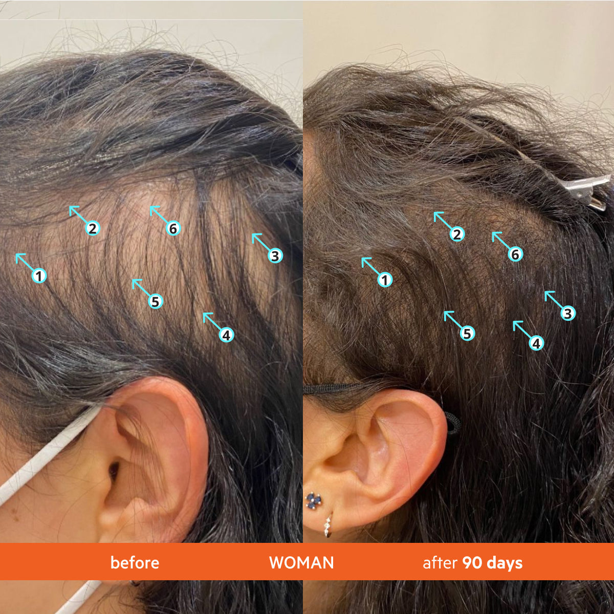 Revita | Champú de alto rendimiento para la DENSIDAD capilar 500 ml