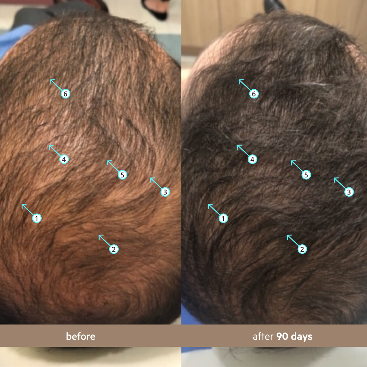 Spectral Men's (DNC-N) | Sérum de densidad capilar con Nanoxidil® 5%