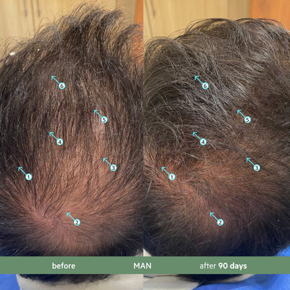 Revita.CBD | Champú CBD superantioxidante para la DENSIDAD capilar