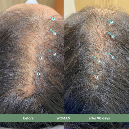 Revita.CBD | Champú CBD superantioxidante para la DENSIDAD capilar