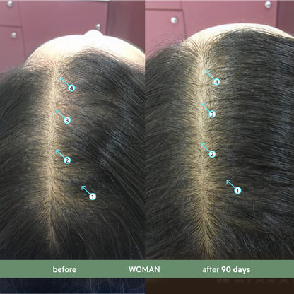 Revita.CBD | Acondicionador CBD superantioxidante para la DENSIDAD capilar