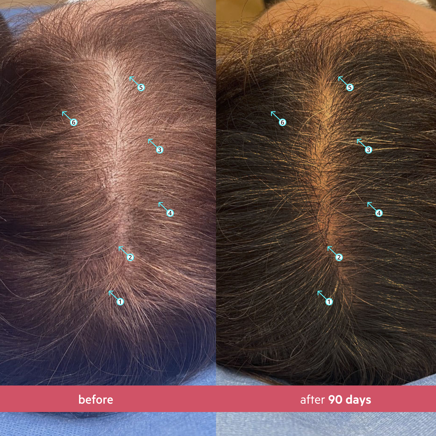 Spectral Women's (CSF) | Sérum revitalizante para mujeres con Nanoxidil 5%