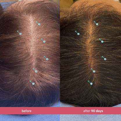 Spectral Women's (CSF) | Sérum revitalizante para mujeres con Nanoxidil 5%